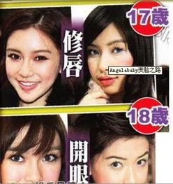 西安整容爆料事件视频最新,揭秘行业乱象,患者权益引关注 第2张 西安整容爆料事件视频最新,揭秘行业乱象,患者权益引关注 第2张